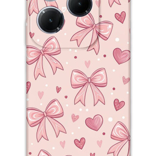 5802-infinix-hot-40-pro-kurdele-desenli-kilif