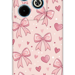 5802-infinix-hot-40i-kurdele-desenli-kilif