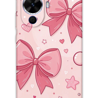 5803-huawei-nova-12s-kurdele-desenli-kilif