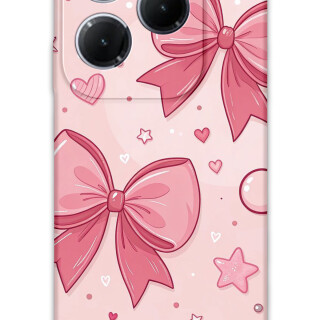 5803-infinix-hot-40-pro-kurdele-desenli-kilif