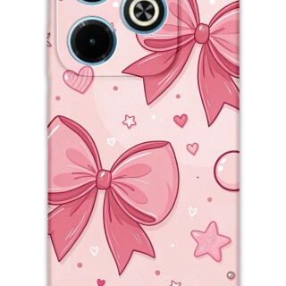 5803-infinix-hot-40i-kurdele-desenli-kilif