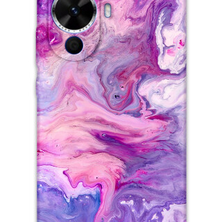 5813-huawei-nova-12s-mermer-desenli-kilif