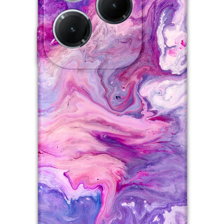 5813-infinix-hot-40-pro-mermer-desenli-kilif