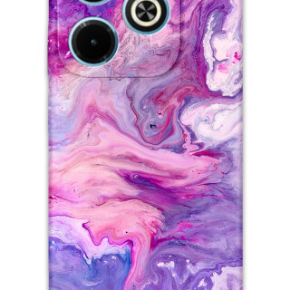 5813-infinix-hot-40i-mermer-desenli-kilif