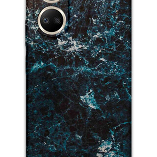 5819-huawei-nova-10-se-mermer-desenli-kilif