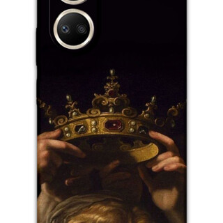 5833-huawei-nova-10-se-retro-desenli-kilif