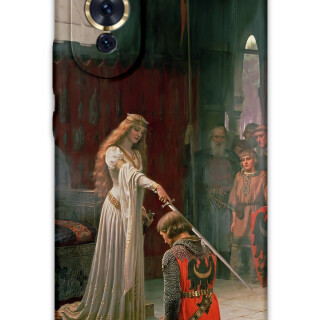 5835-huawei-nova-10-nova-10-pro-retro-desenli-kilif