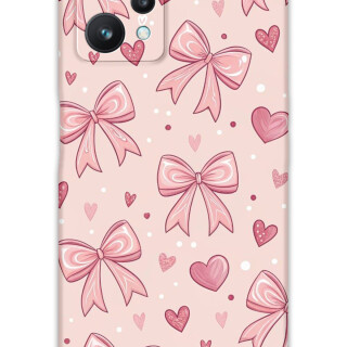 5802-realme-9-pro-kurdele-desenli-kilif