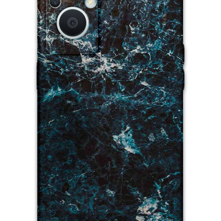 5819-oppo-reno-7-lite-mermer-desenli-kilif