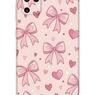 5802-galaxy-s20-plus-kurdele-desenli-kilif