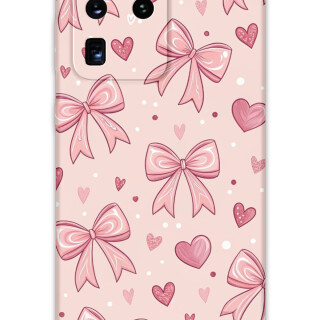 5802-galaxy-s20-ultra-kurdele-desenli-kilif