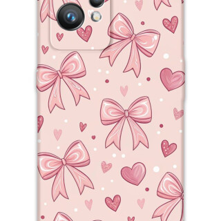 5802-realme-gt-2-gt-2-pro-kurdele-desenli-kilif