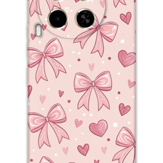 5802-tecno-camon-30-kurdele-desenli-kilif