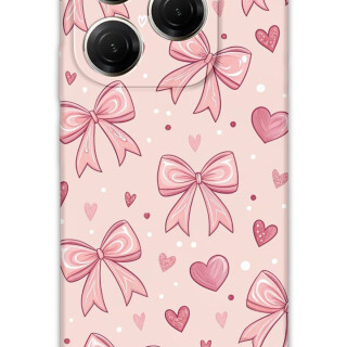 5802-tecno-spark-20-pro-5g-kurdele-desenli-kilif