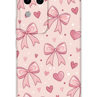 5802-vivo-v30-kurdele-desenli-kilif