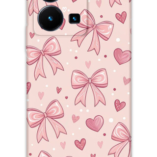 5802-vivo-y22s-y35-kurdele-desenli-kilif