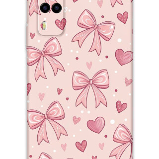 5802-vivo-y53s-kurdele-desenli-kilif