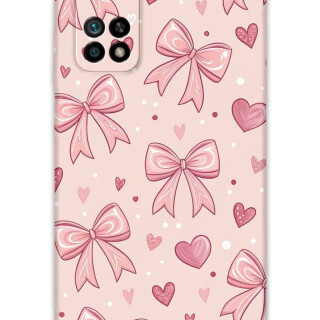 5802-xiaomi-mi-10t-mi-10t-pro-kurdele-desenli-kilif