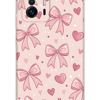 5802-xiaomi-mi-11t-mi-11t-pro-kurdele-desenli-kilif