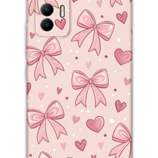 5802-xiaomi-mi-12-lite-kurdele-desenli-kilif