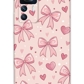 5802-xiaomi-mi-12t-mi-12t-pro-kurdele-desenli-kilif