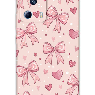 5802-xiaomi-mi-13-lite-kurdele-desenli-kilif