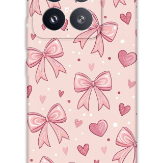 5802-xiaomi-mi-15-mi-15-pro-kurdele-desenli-kilif