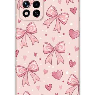 5802-xiaomi-poco-m4-pro-5g-note-11-pro-plus-5g-kurdele-desenli-kilif