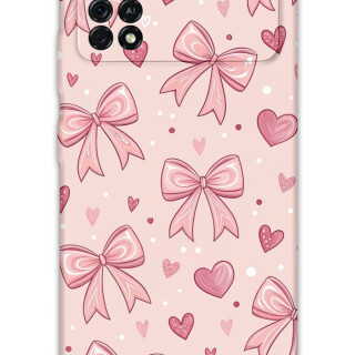 5802-xiaomi-poco-x4-pro-5g-kurdele-desenli-kilif