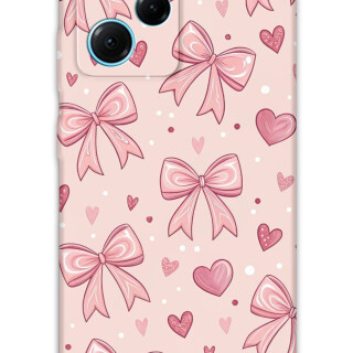 5802-xiaomi-poco-x5-pro-kurdele-desenli-kilif