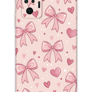 5802-xiaomi-redmi-note-10-pro-kurdele-desenli-kilif