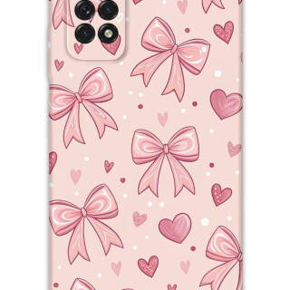 5802-xiaomi-redmi-note-11-note-11s-note-11-pro-5g-kurdele-desenli-kilif