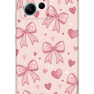 5802-xiaomi-redmi-note-12-4g-kurdele-desenli-kilif