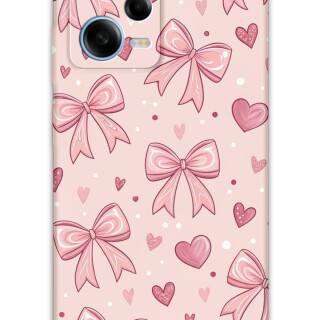 5802-xiaomi-redmi-note-12-pro-5g-redmi-note-12-5g-kurdele-desenli-kilif