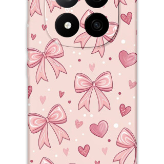 5802-xiaomi-redmi-note-14-pro-redmi-note-14-pro-plus-poco-x7-kurdele-desenli-kilif