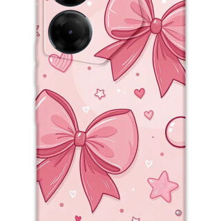 5803-tecno-camon-20-20-pro-4g-kurdele-desenli-kilif