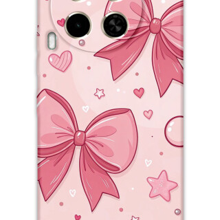 5803-tecno-camon-30-kurdele-desenli-kilif