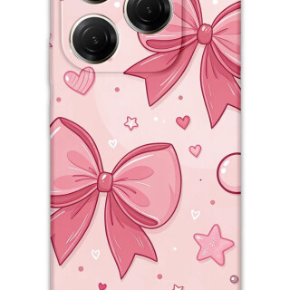 5803-tecno-spark-20-pro-5g-kurdele-desenli-kilif