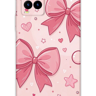 5803-vivo-y21s-y32-y33s-kurdele-desenli-kilif