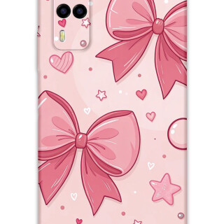 5803-vivo-y53s-kurdele-desenli-kilif