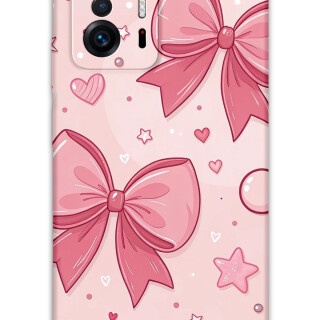 5803-xiaomi-mi-11t-mi-11t-pro-kurdele-desenli-kilif