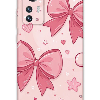 5803-xiaomi-mi-12-mi-12-pro-kurdele-desenli-kilif