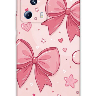 5803-xiaomi-mi-13-lite-kurdele-desenli-kilif