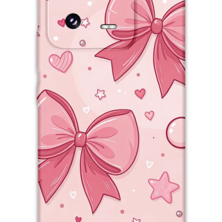 5803-xiaomi-mi-13-mi-13-pro-kurdele-desenli-kilif