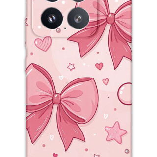 5803-xiaomi-mi-15-mi-15-pro-kurdele-desenli-kilif