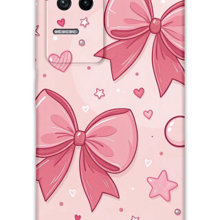 5803-xiaomi-poco-f4-kurdele-desenli-kilif