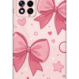 5803-xiaomi-poco-m4-pro-5g-note-11-pro-plus-5g-kurdele-desenli-kilif