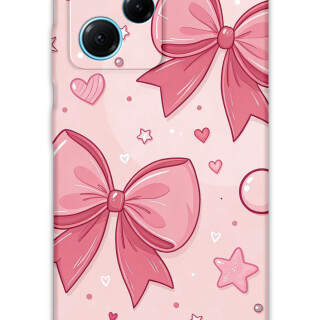 5803-xiaomi-poco-x5-pro-kurdele-desenli-kilif