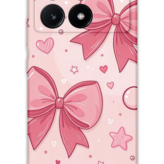 5803-xiaomi-poco-x6-pro-kurdele-desenli-kilif