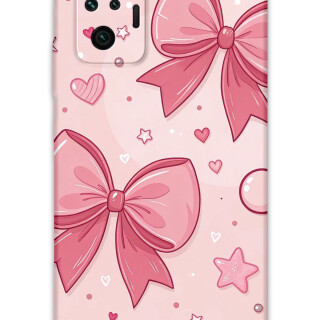 5803-xiaomi-redmi-note-10-pro-kurdele-desenli-kilif